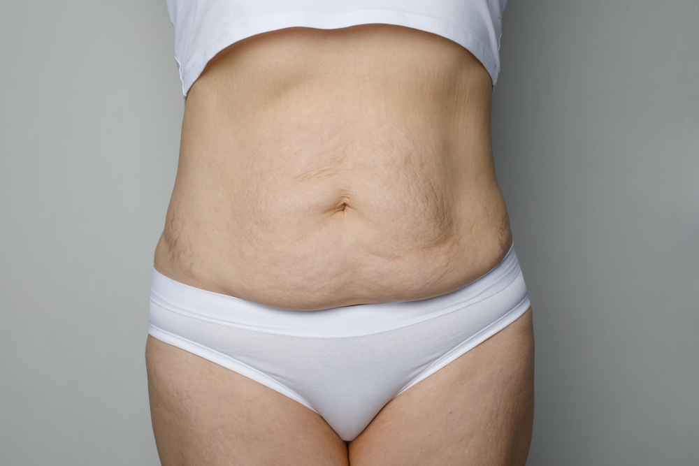 drenagem linfática em bh